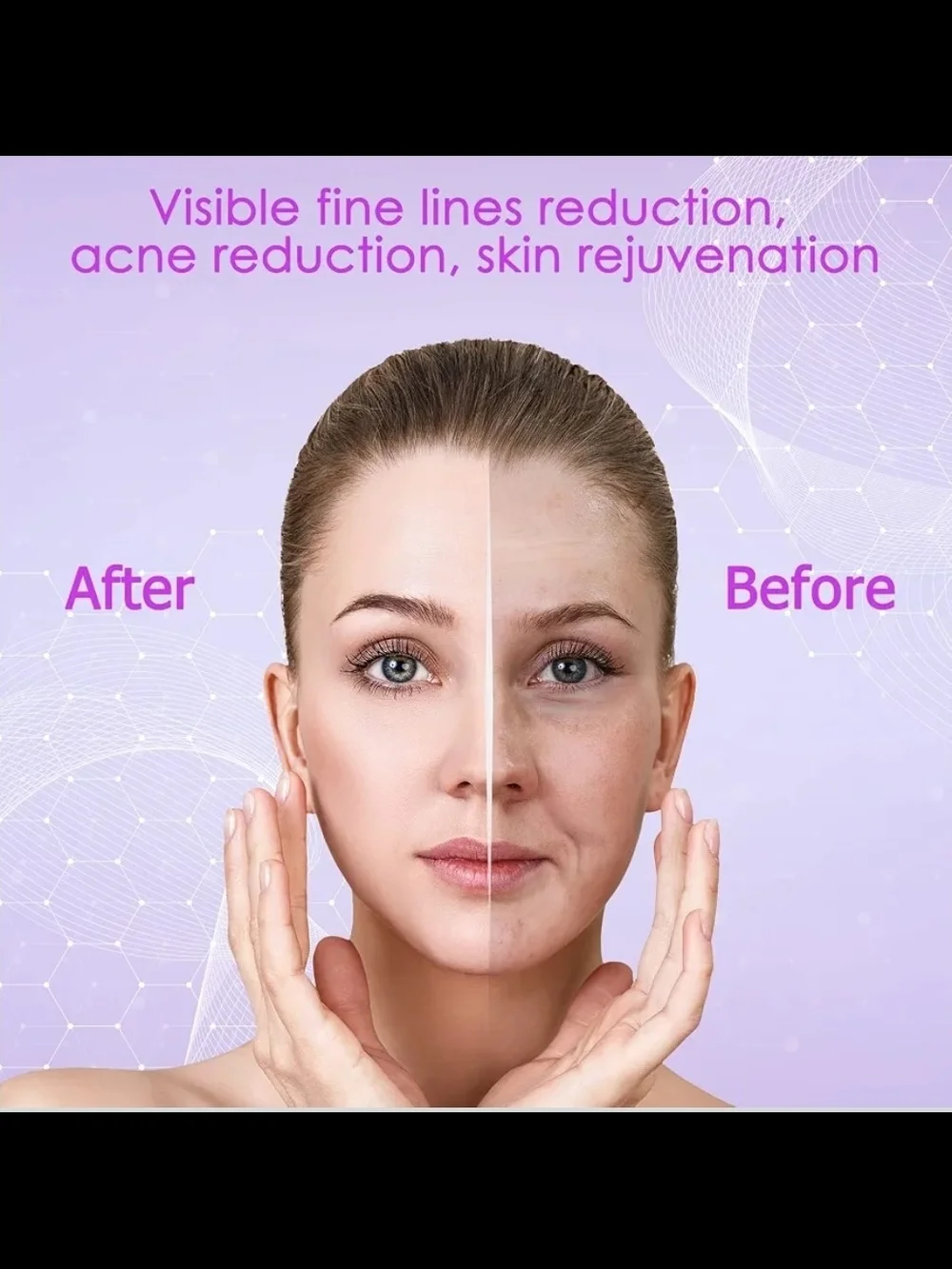 YourMate PhotoTherapy Device High Frequency Facial Wand Machine Argon